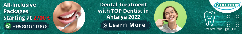 Dental Implants in Antalya